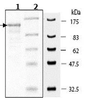 SDS-PAGE - Recombinant human DPP8 protein (GST tag N-Terminus + His tag N-Terminus) (AB79662)