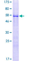Recombinant Human Dppa2 protein