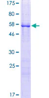 SDS-PAGE - Recombinant Human Dppa2 protein (GST tag N-Terminus) (AB133004)