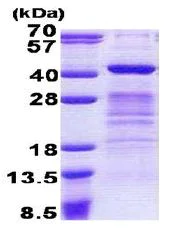 SDS-PAGE - Recombinant Human Dppa4 protein (AB167860)