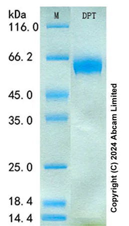 SDS-PAGE - Recombinant Human DPT Protein Standard (His tag) (AB322091)