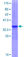 SDS-PAGE - Recombinant Human DR3/LARD protein (AB160160)