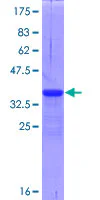 SDS-PAGE - Recombinant Human DR3/LARD protein (GST tag N-Terminus) (AB160160)