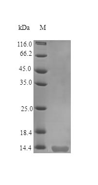 Recombinant human DR5 protein (Active)