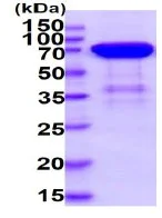 SDS-PAGE - Recombinant Human DR6 protein (Fc tag C-Terminus + His tag C-Terminus) (AB235878)