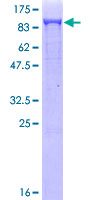 SDS-PAGE - Recombinant Human DRP1 protein (AB153041)