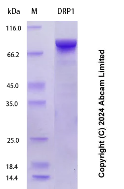 SDS-PAGE - Recombinant Human DRP1 Protein Standard (His tag) (AB323076)