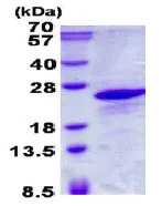 SDS-PAGE - Recombinant Human DS-1 protein (AB137167)