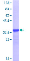 SDS-PAGE - Recombinant Human DSCAML1 protein (AB163552)