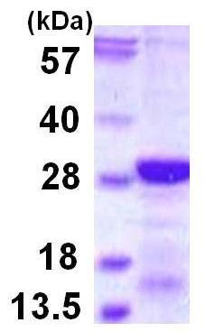 SDS-PAGE - Recombinant Human DSCR1L1 protein (His tag N-Terminus) (AB115724)