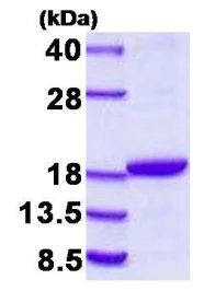 SDS-PAGE - Recombinant Human DSTN protein (His tag C-Terminus) (AB128429)