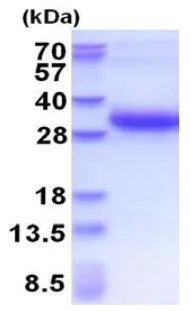 SDS-PAGE - Recombinant Human DSU protein (His tag) (AB177607)