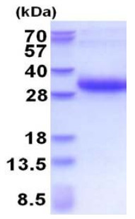 SDS-PAGE - Recombinant Human DSU protein (His tag N-Terminus) (AB177607)