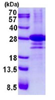 SDS-PAGE - Recombinant Human DTD1 protein (AB137172)