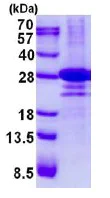 SDS-PAGE - Recombinant Human DTD1 protein (AB137172)