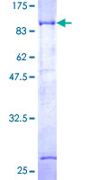 Recombinant Human DTN-B protein