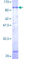 SDS-PAGE - Recombinant Human DTN-B protein (AB158324)