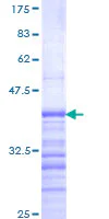 SDS-PAGE - Recombinant Human Dub3 protein (AB112436)