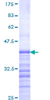 SDS-PAGE - Recombinant Human Dub3 protein (GST tag N-Terminus) (AB112436)