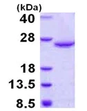 SDS-PAGE - Recombinant Human DUSP18 protein (His tag N-Terminus) (AB123154)