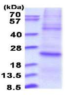 SDS-PAGE - Recombinant Human DUSP22 protein (denatured) (AB180296)