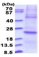 SDS-PAGE - Recombinant Human DUSP22 protein (denatured) (His tag N-Terminus) (AB180296)