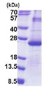 SDS-PAGE - Recombinant Human DUSP26 protein (denatured) (AB171697), expandable thumbnail