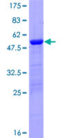 SDS-PAGE - Recombinant Human DUSP27 protein (GST tag N-Terminus) (AB166252)