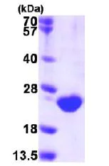 SDS-PAGE - Recombinant Human DUSP3 protein (His tag N-Terminus) (AB113160)