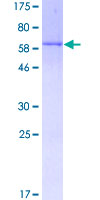 SDS-PAGE - Recombinant Human DUSP4 protein (GST tag N-Terminus) (AB132331)