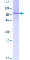 SDS-PAGE - Recombinant Human DUSP4 protein (GST tag N-Terminus) (AB132331)