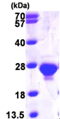 SDS-PAGE - Recombinant Human dUTPase protein (AB99388)