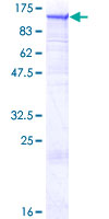 SDS-PAGE - Recombinant Human Dynamin 2 protein (GST tag N-Terminus) (AB132947)