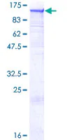 SDS-PAGE - Recombinant Human Dynamin 2 protein (GST tag N-Terminus) (AB132947)