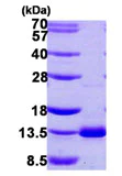 SDS-PAGE - Recombinant Human Dynein light chain protein (AB107140)
