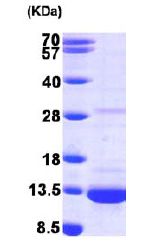 SDS-PAGE - Recombinant Human DYNLL1/PIN protein (His tag N-Terminus) (AB101204)