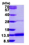 SDS-PAGE - Recombinant Human DYNLRB2 protein (AB104646)