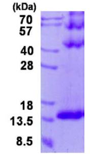 SDS-PAGE - Recombinant Human DYNLT3 protein (AB131687)