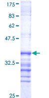 Recombinant Human DYRK1A protein