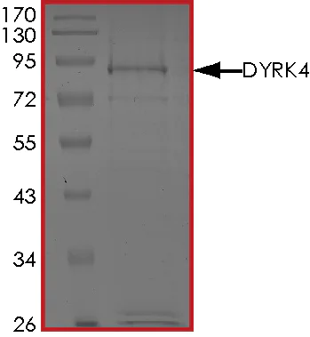 SDS-PAGE - Recombinant human DYRK4 protein (Active) (AB268452)