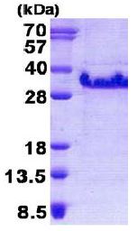 SDS-PAGE - Recombinant Human Dysadherin protein (His tag N-Terminus) (AB140573)