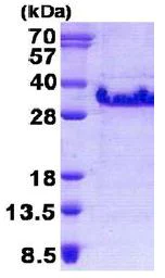 SDS-PAGE - Recombinant Human Dysadherin protein (His tag N-Terminus) (AB140573)