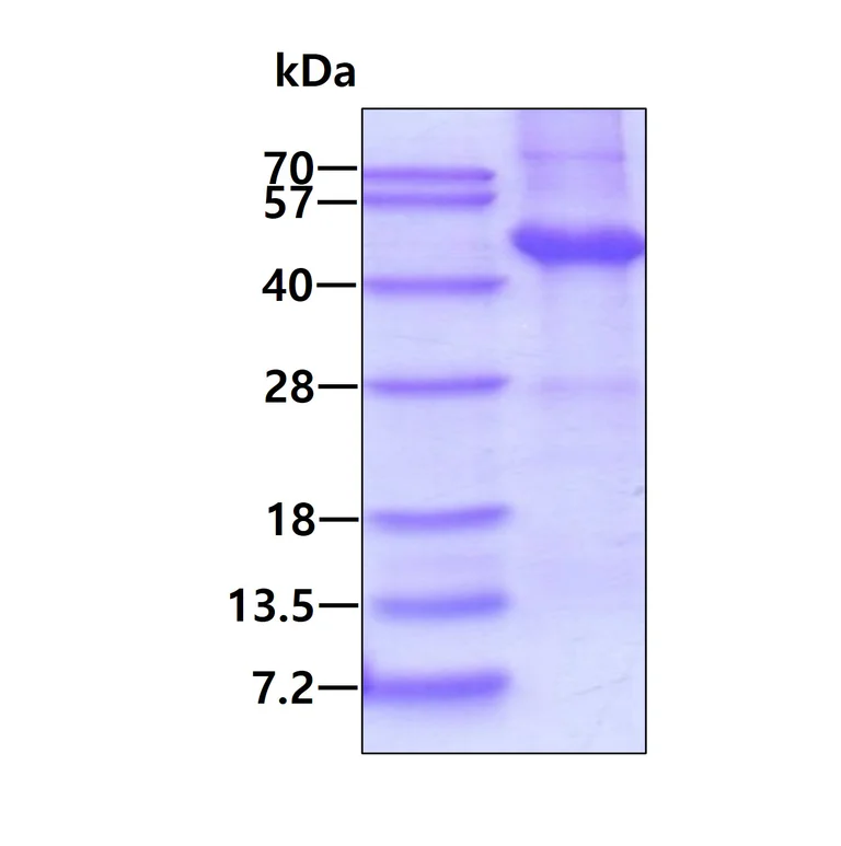 SDS-PAGE - Recombinant Human Dysbindin protein (AB87462)
