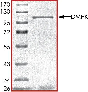 SDS-PAGE - Recombinant human Dystrophia myotonica protein kinase / DMPK (AB85755)