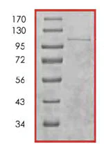 SDS-PAGE - Recombinant human Dystrophia myotonica protein kinase / DMPK (AB85755)