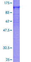 Recombinant Human Dystrophin protein (Tagged)