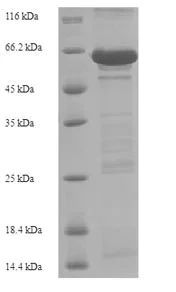 SDS-PAGE - Recombinant Human E Cadherin protein (AB235682)