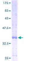 SDS-PAGE - Recombinant Human E2F2 protein (GST tag N-Terminus) (AB114610)
