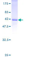 SDS-PAGE - Recombinant Human E2F6 protein (GST tag N-Terminus) (AB114573)