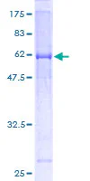 SDS-PAGE - Recombinant Human E3 ubiquitin-protein ligase MUL1 (GST tag N-Terminus) (AB153508)
